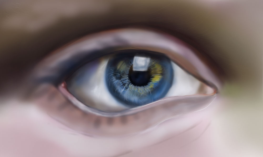 26